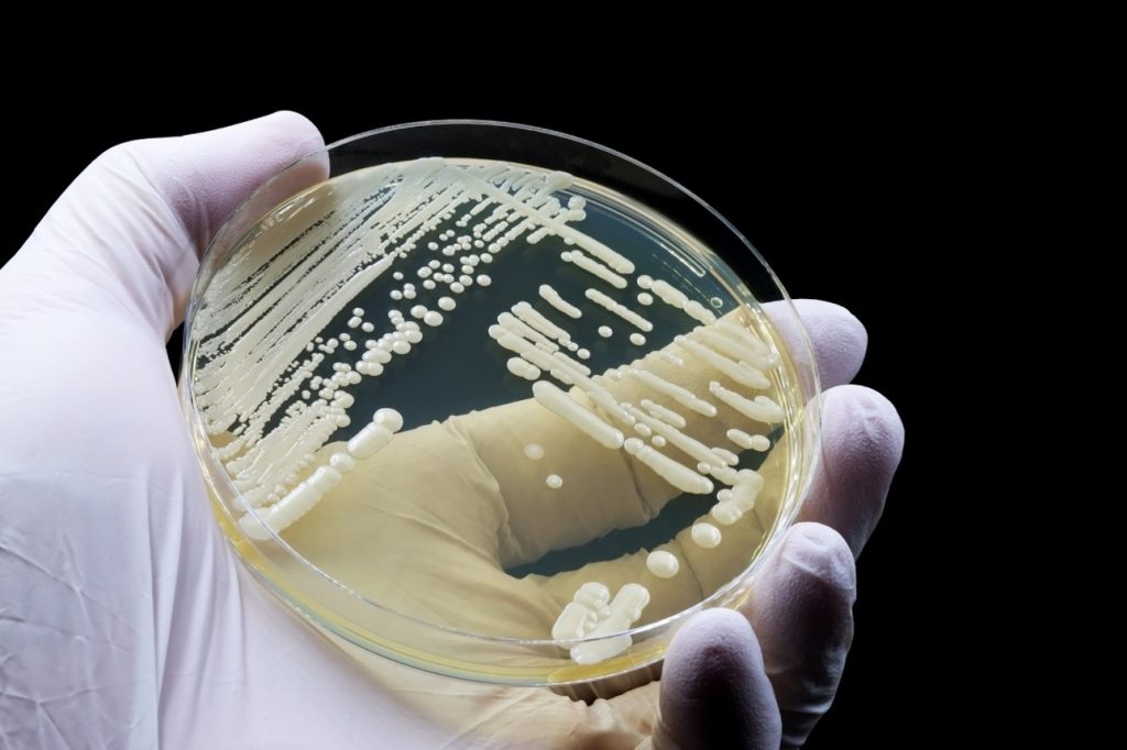 Petri dish held in a gloved hand showing streaked bacterial colonies growing on agar, with visible lines of inoculation and clusters of white, raised colonies.